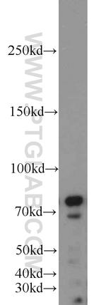 INTS9 Antibody in Western Blot (WB)