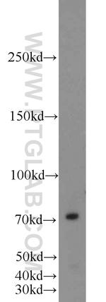 INTS9 Antibody in Western Blot (WB)