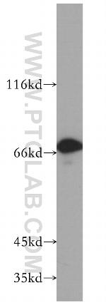 INTS9 Antibody in Western Blot (WB)