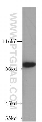 INTS9 Antibody in Western Blot (WB)