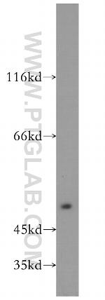 INTS9 Antibody in Western Blot (WB)