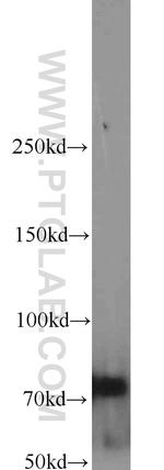 INTS9 Antibody in Western Blot (WB)