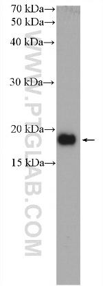 CPI17 Antibody in Western Blot (WB)