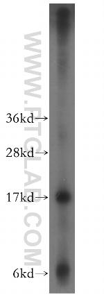 CPI17 Antibody in Western Blot (WB)