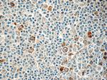 RRM2 Antibody in Immunohistochemistry (Paraffin) (IHC (P))