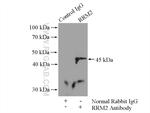 RRM2 Antibody in Immunoprecipitation (IP)