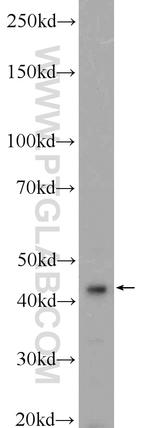 PPP1R7 Antibody in Western Blot (WB)