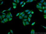 WSB1 Antibody in Immunocytochemistry (ICC/IF)