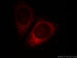 WSB1 Antibody in Immunocytochemistry (ICC/IF)