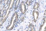 WSB1 Antibody in Immunohistochemistry (Paraffin) (IHC (P))