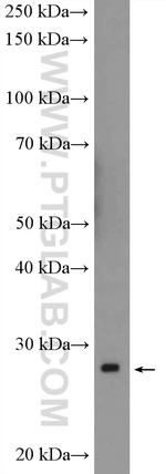 MOBKL1B Antibody in Western Blot (WB)