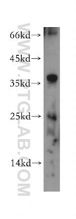 MOBKL1B Antibody in Western Blot (WB)