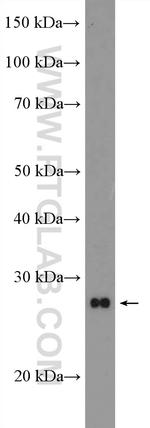 MOBKL1B Antibody in Western Blot (WB)