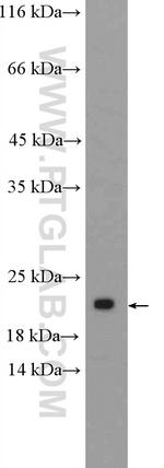 SSX1 Antibody in Western Blot (WB)