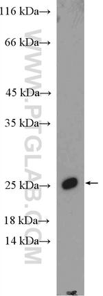 SSX1 Antibody in Western Blot (WB)