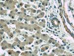 RAB1A Antibody in Immunohistochemistry (Paraffin) (IHC (P))