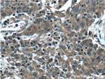 RAB1A Antibody in Immunohistochemistry (Paraffin) (IHC (P))