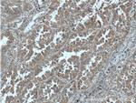 RAB1A Antibody in Immunohistochemistry (Paraffin) (IHC (P))