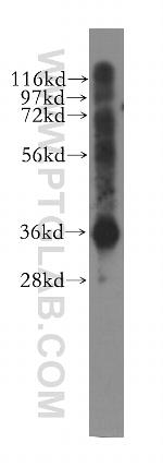 PDLIM1/CLP36 Antibody in Western Blot (WB)