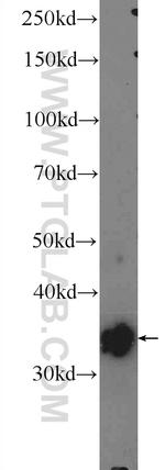 PDLIM1/CLP36 Antibody in Western Blot (WB)