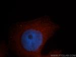 PDLIM1/CLP36 Antibody in Immunocytochemistry (ICC/IF)