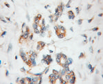 PDLIM1/CLP36 Antibody in Immunohistochemistry (Paraffin) (IHC (P))
