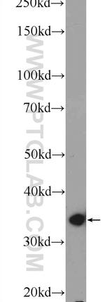 PDLIM1/CLP36 Antibody in Western Blot (WB)