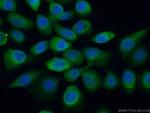 SUGT1 Antibody in Immunocytochemistry (ICC/IF)