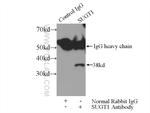 SUGT1 Antibody in Immunoprecipitation (IP)