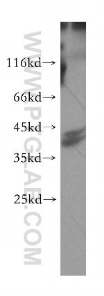 SUGT1 Antibody in Western Blot (WB)