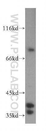 SUGT1 Antibody in Western Blot (WB)
