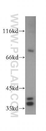 SUGT1 Antibody in Western Blot (WB)