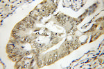 TTC1 Antibody in Immunohistochemistry (Paraffin) (IHC (P))