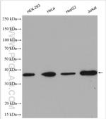 TTC1 Antibody in Western Blot (WB)