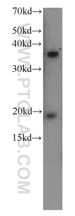 TTC1 Antibody in Western Blot (WB)