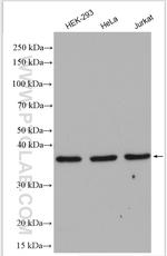TTC1 Antibody in Western Blot (WB)