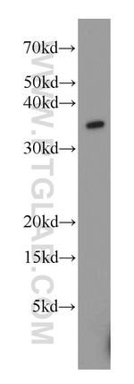 TTC1 Antibody in Western Blot (WB)