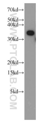 TTC1 Antibody in Western Blot (WB)