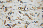 UBE2D3 Antibody in Immunohistochemistry (Paraffin) (IHC (P))