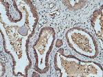 UBE2D3 Antibody in Immunohistochemistry (Paraffin) (IHC (P))