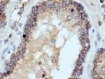UBE2D3 Antibody in Immunohistochemistry (Paraffin) (IHC (P))