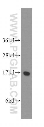 UBE2D3 Antibody in Western Blot (WB)