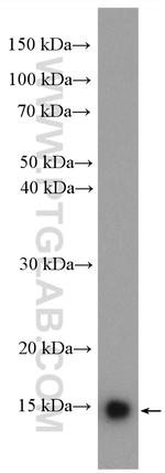 UBE2D3 Antibody in Western Blot (WB)