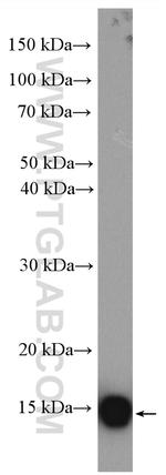 UBE2D3 Antibody in Western Blot (WB)