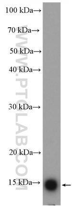 UBE2D3 Antibody in Western Blot (WB)