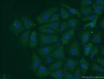 PARK7/DJ-1 Antibody in Immunocytochemistry (ICC/IF)