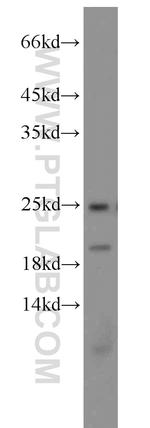 PARK7/DJ-1 Antibody in Western Blot (WB)