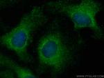 Ferritin heavy chain Antibody in Immunocytochemistry (ICC/IF)