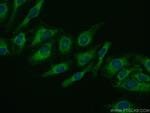 Ferritin heavy chain Antibody in Immunocytochemistry (ICC/IF)
