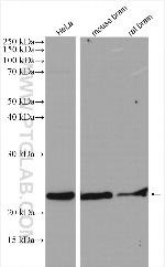 PSMB6 Antibody in Western Blot (WB)